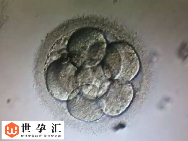 三天胚胎和五六天胚胎的等级划分标准是一样的吗?(图1) 三天胚胎和五六天胚胎的等级划分标准是一样的吗?(图1)