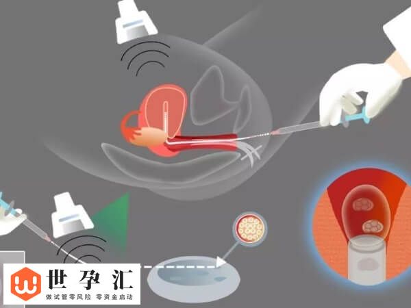 10c4胚胎是不是优质的(图3) 10c4胚胎是不是优质的(图3)