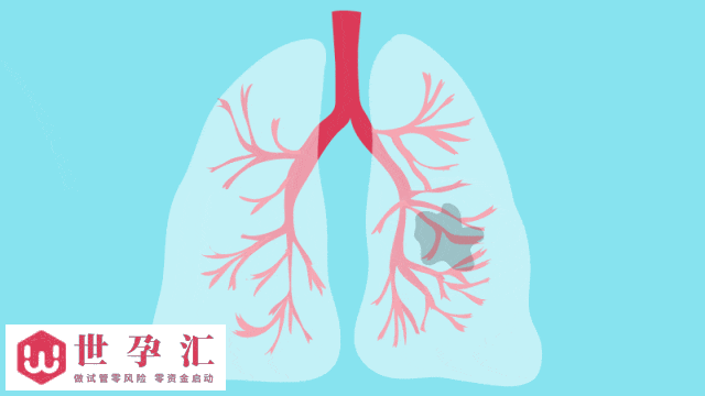 慢阻肺防治卡点仍不少(图1)