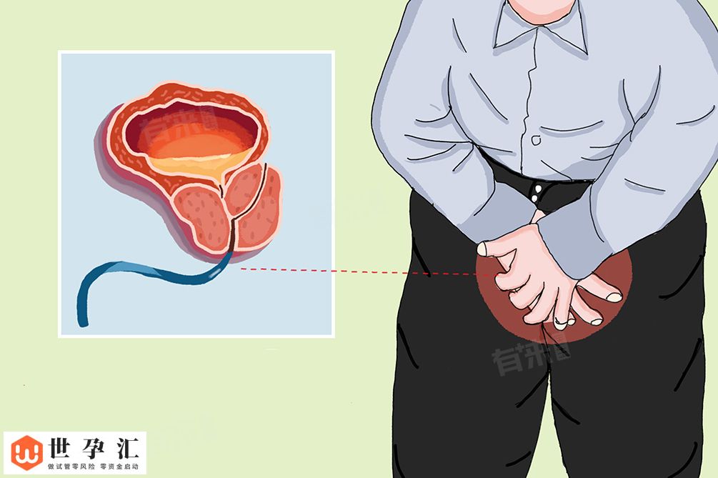 前列腺炎症状能自愈吗
