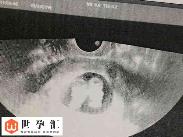 试管孩子是不是真的智商低(图4) 试管孩子是不是真的智商低(图4)