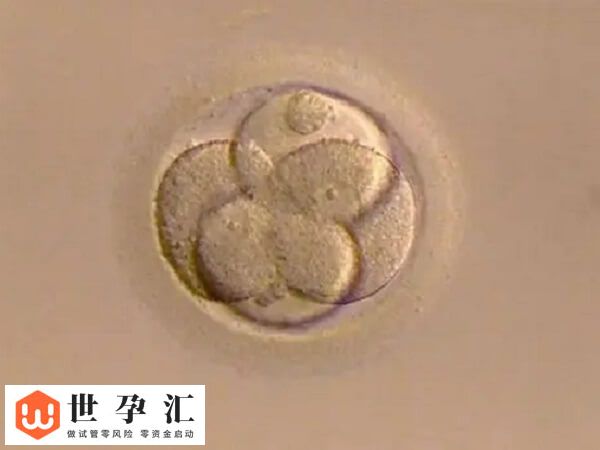 试管精卵结合却不发育怎么办(图2) 试管精卵结合却不发育怎么办(图2)