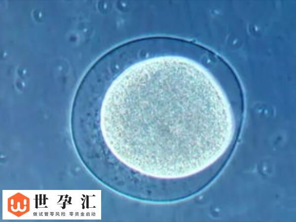 试管移植后耳鸣是不是成了(图2)