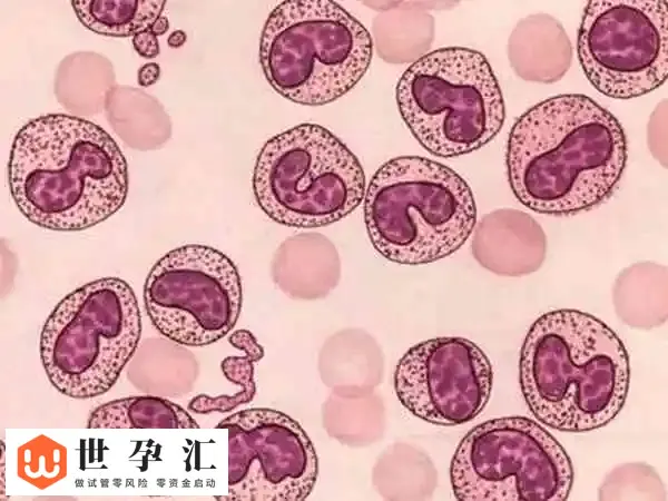 试管移植后白细胞高是什么原因(图2) 试管移植后白细胞高是什么原因(图2)