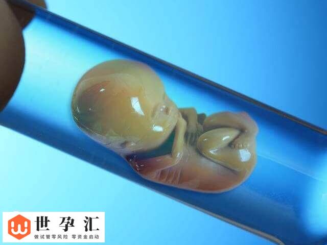 前列腺炎对试管婴儿的影响有哪些